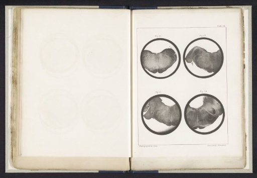Four Details of a Medulla Oblongata of a Human