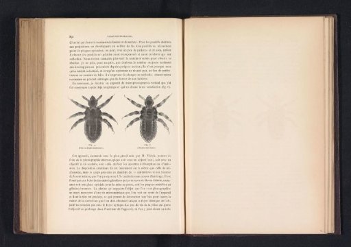 Lice