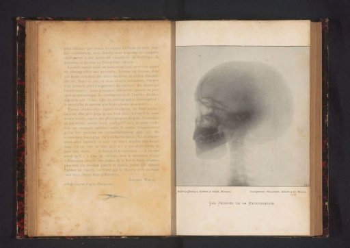 X-ray of a human skull
