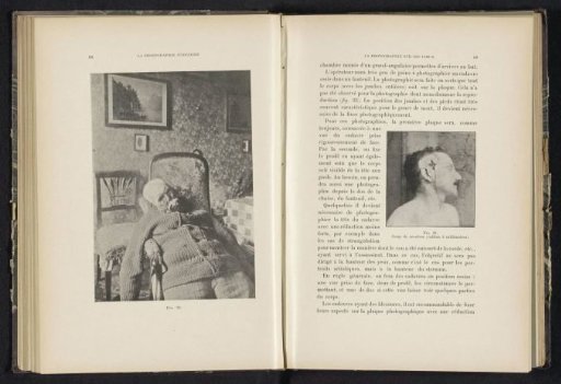 Head of a dead man with a gunshot wound
