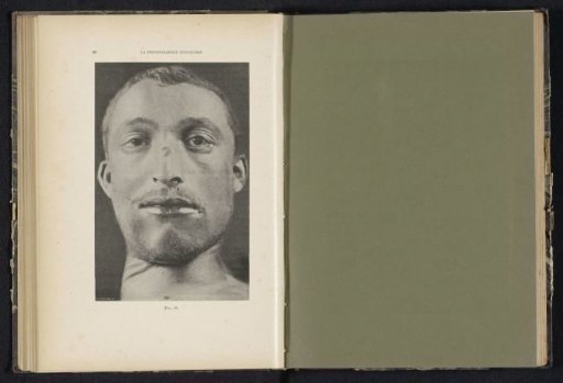 Head of a dead man