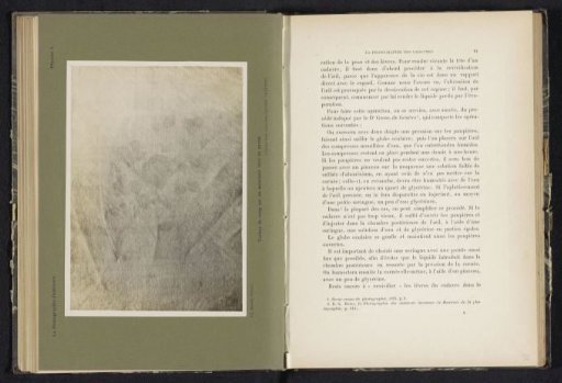 Blood spatters on a soap-washed handkerchief