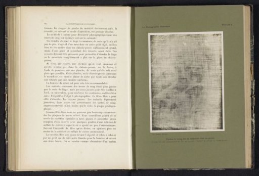 Blood spatters on a soap-washed handkerchief