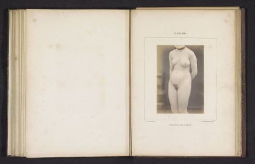 Woman with a rash caused by syphilis