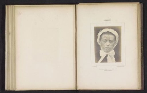 Portrait of an unknown person with a rash caused by syphilis