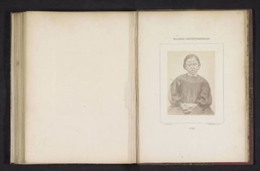 Portrait of an unknown woman suffering from leprosy