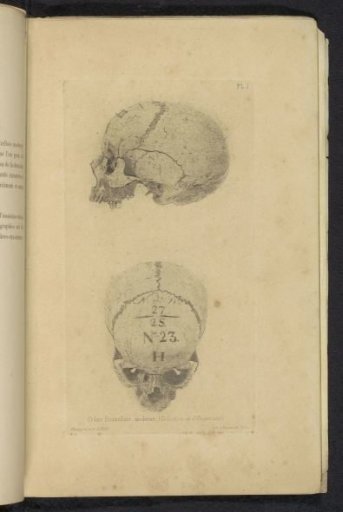 Two Views of a Skull