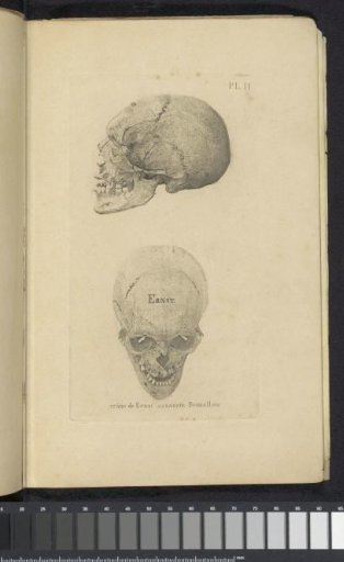 Two Views of a Skull