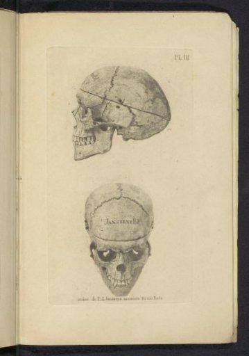Two Views of the Skull of P.J. Janssens