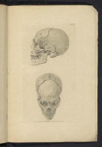 Two Views of the Skull of A.J. Saroléa