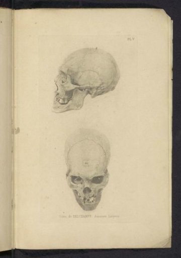 Two Views of a Skull