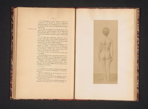 Nude girl, seen from behind