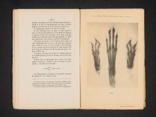 X-ray of three hare's feet