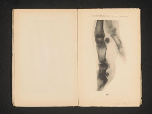 X-ray of a pig's foot