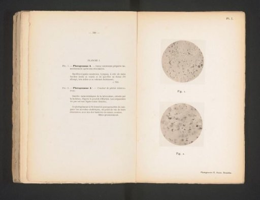 Two microphotographs of cholera