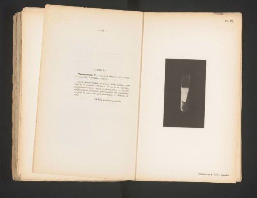 Scientific photograph of cholera in gelatin