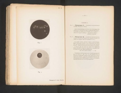 Two microscopic photographs of cholera