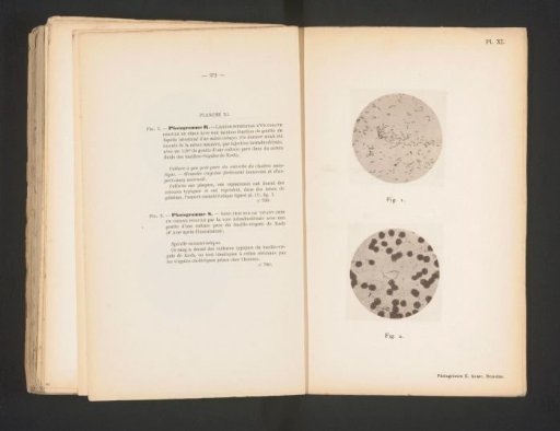 Two microscopic photographs of guinea pig intestinal juice and blood