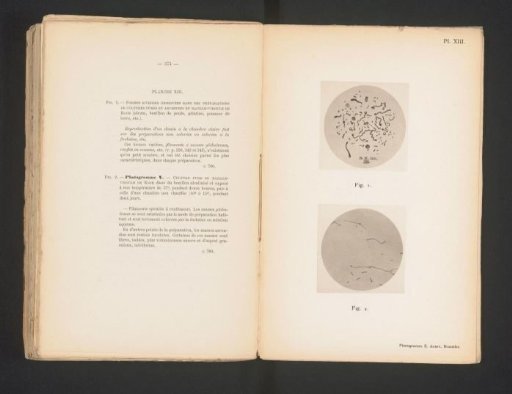 Microscopic photograph of cholera and a photographic reproduction of a drawing thereof