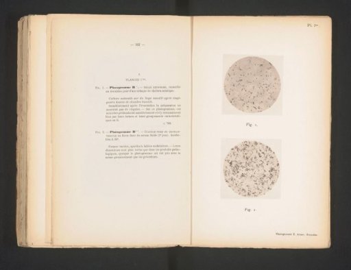 Two microphotographs of cholera