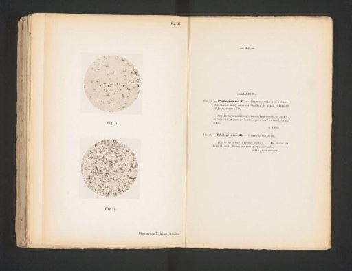 Two microphotographs of cholera