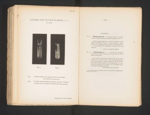 Two scientific photographs of cholera in gelatin