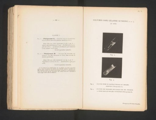 Two scientific photographs of cholera in gelatin