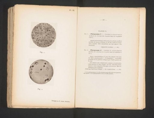 Two microscopic photographs of cholera