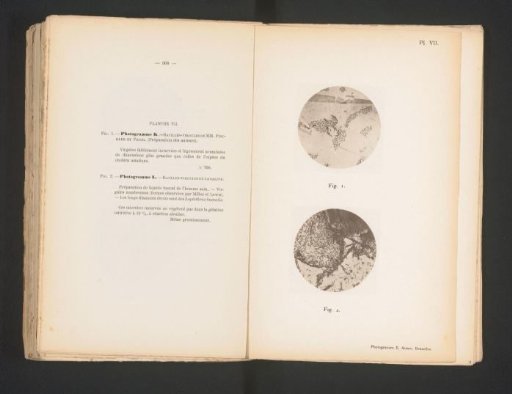 Two microscopic photographs of cholera