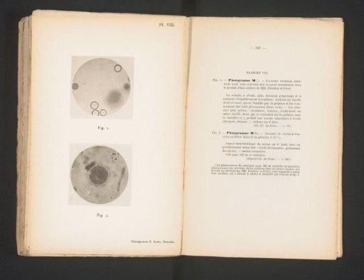 Two microscopic photographs of cholera