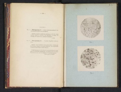 Two microscopic photographs of cholera