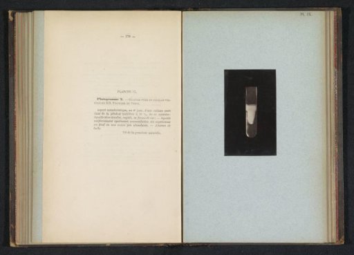 Scientific photograph of cholera in gelatin