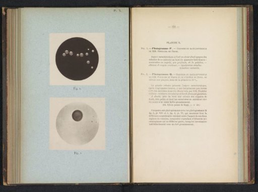 Two microphotographs of cholera