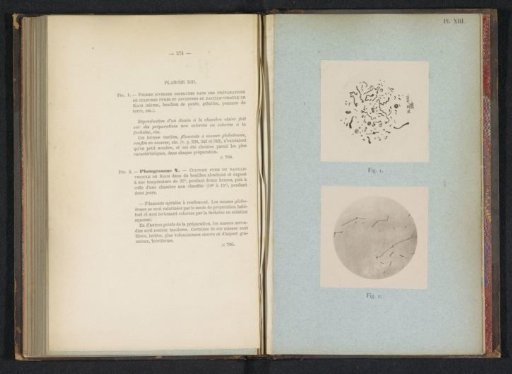 Microphotograph of cholera and a photographic reproduction of a drawing thereof