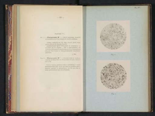 Two microscopic photographs of cholera