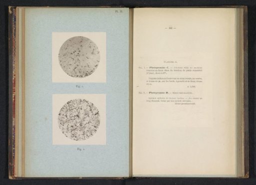 Two microphotographs of cholera