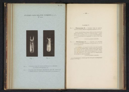 Two scientific photographs of cholera in gelatin