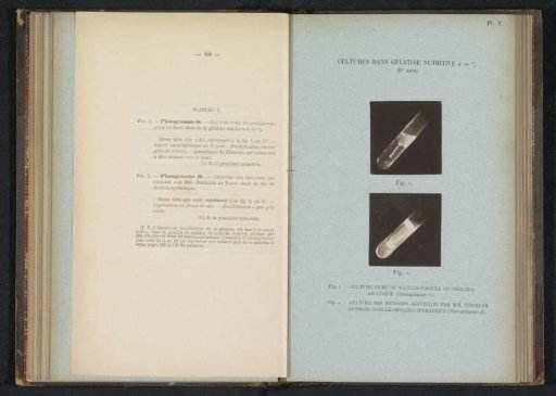Two scientific photographs of cholera in gelatin