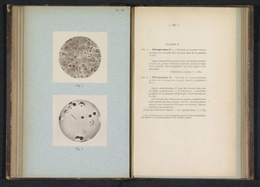 Two microphotographs of cholera