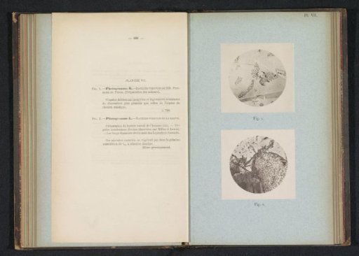 Two microphotographs of cholera