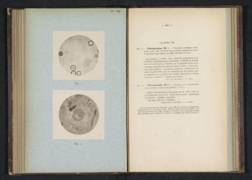 Two microphotographs of cholera