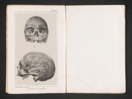 Front and side view of a skull
