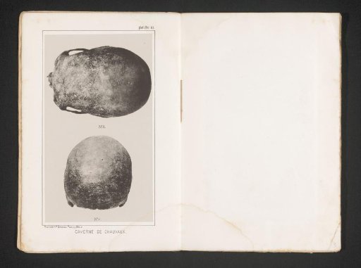 Top and rear view of a skull