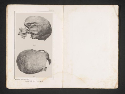 Side and rear view of a skull