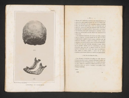 Rear view of a skull and view of a lower jaw