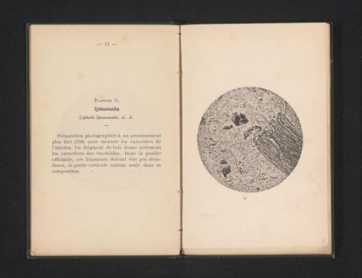 Microscopic representation of ipecac