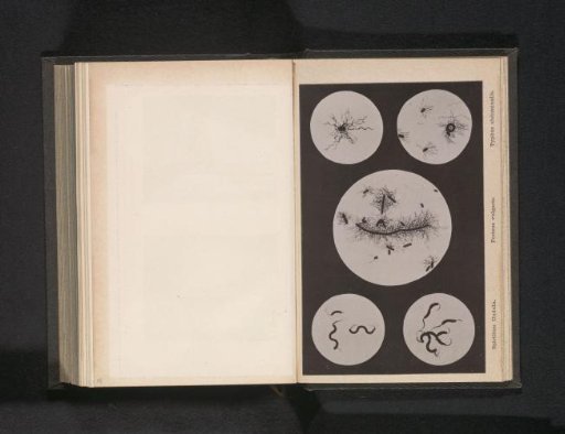 Microscopic Images of Spirilla, Proteus vulgaris, and Typhoid Fever