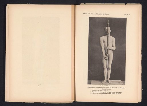 Unknown Nude Man, Front View, with a Rifle in His Hands