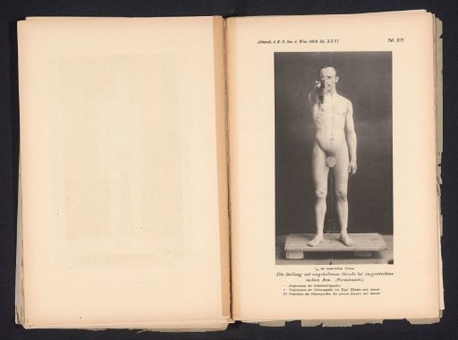 Unknown Nude Man, Front View, with a Rifle in His Right Hand