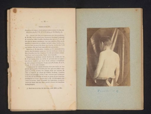 Man with bare upper body, seen from the back